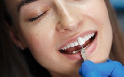 Long-Term Care for Veneers: Tips and Best Practices