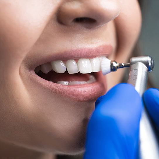 dental cleaning dentist in Edmond
