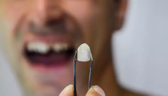 What To Do If You Chip Or Break A Tooth