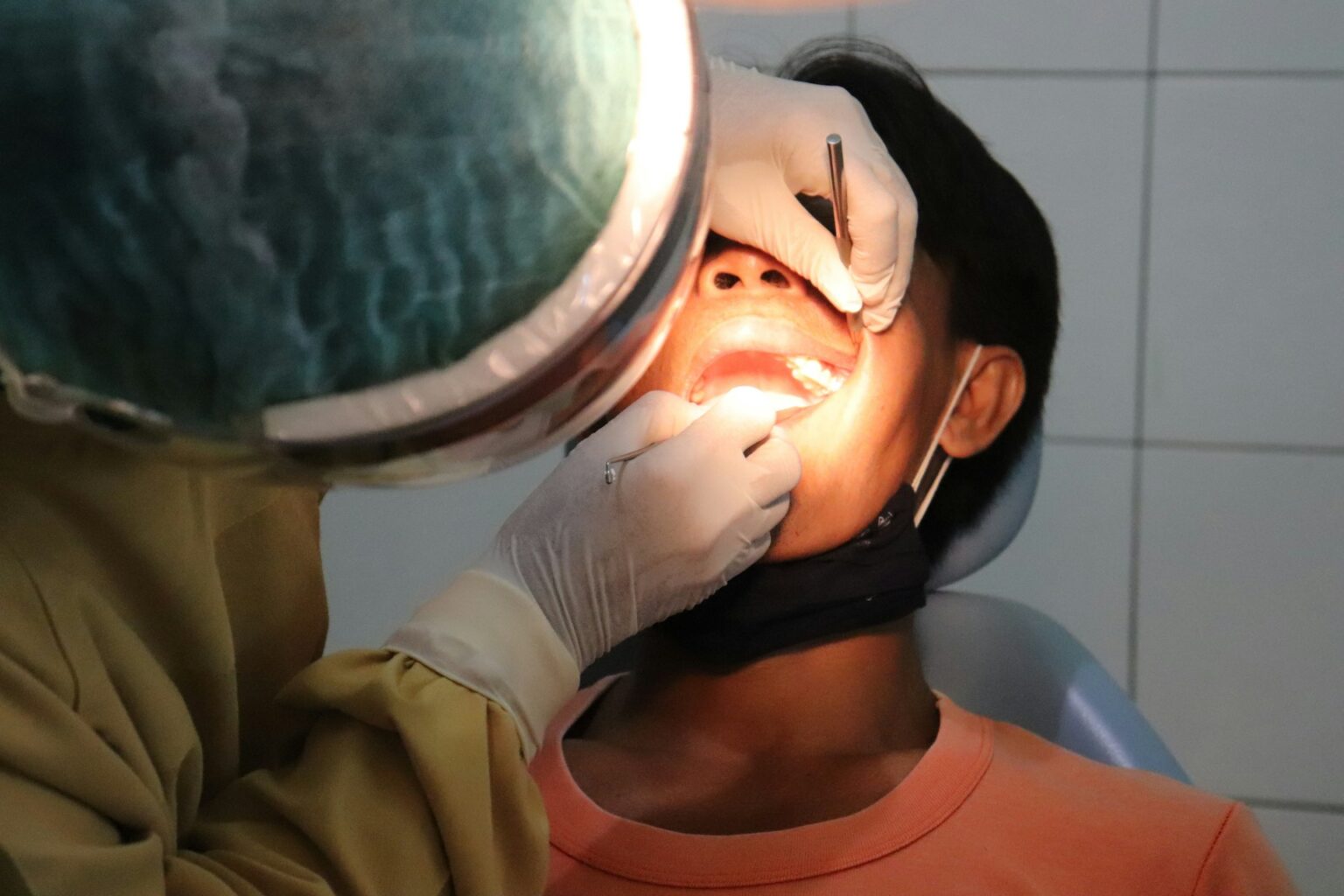 Benefits of Fluoride Treatments for Adults: Protect Your Smile and Prevent Cavities