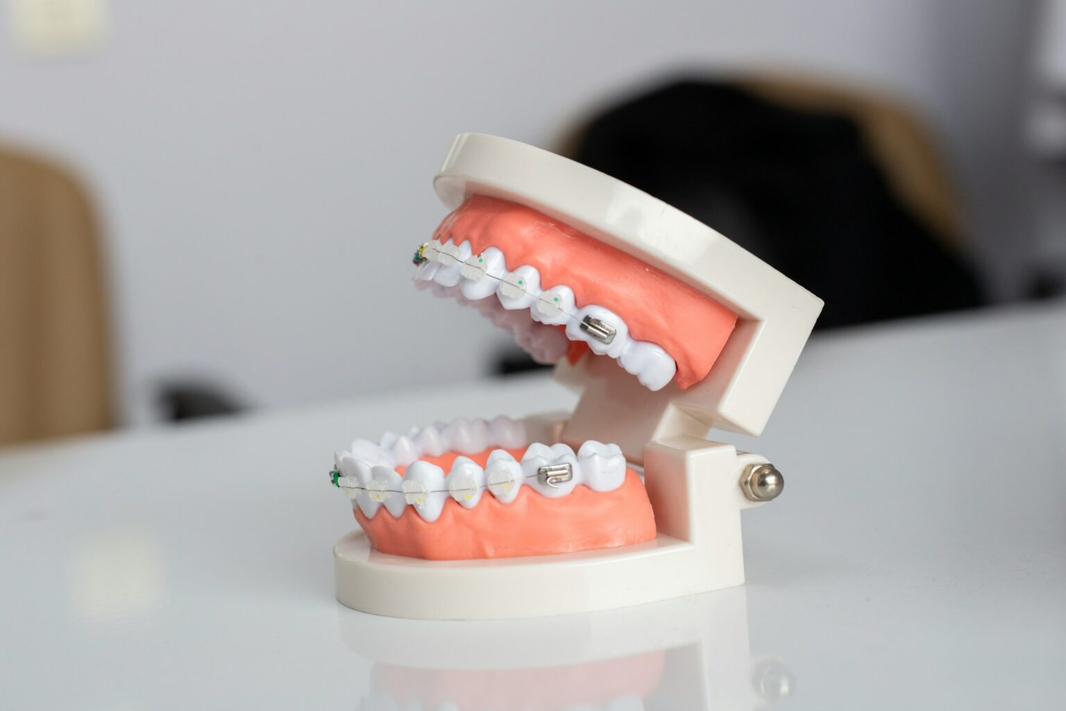 Can a Retainer Fix an Overbite? What You Need to Know