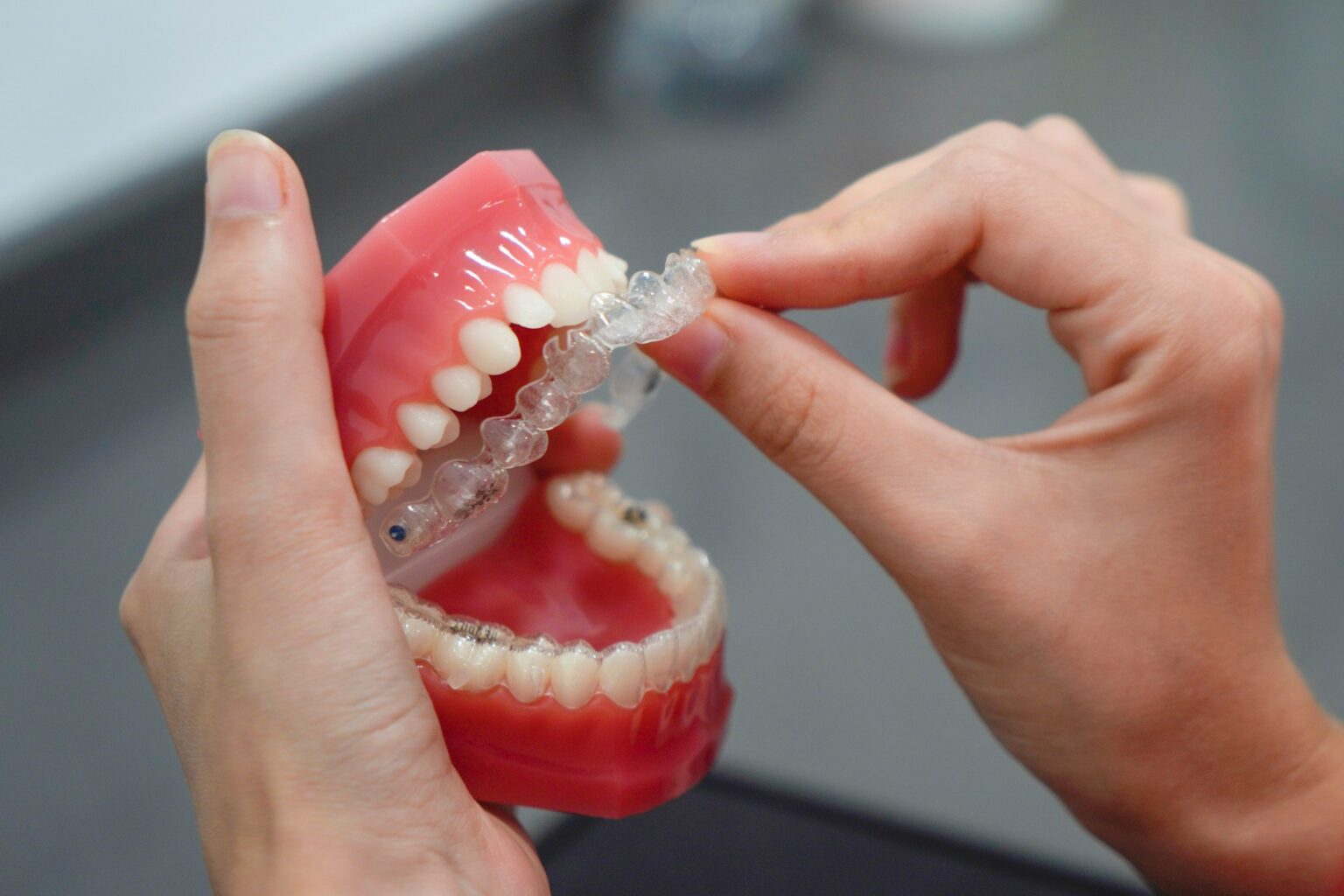 Does Invisalign Hurt? What to Expect with Clear Aligners