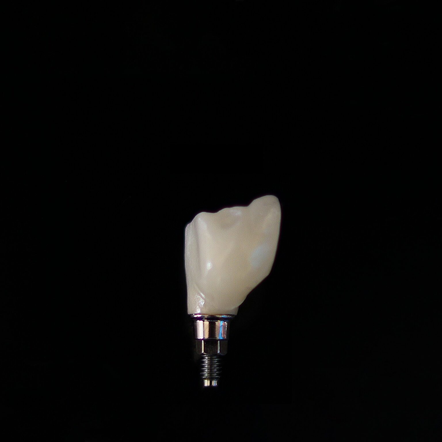 What Are Screwless Dental Implants: Benefits to Your Smile